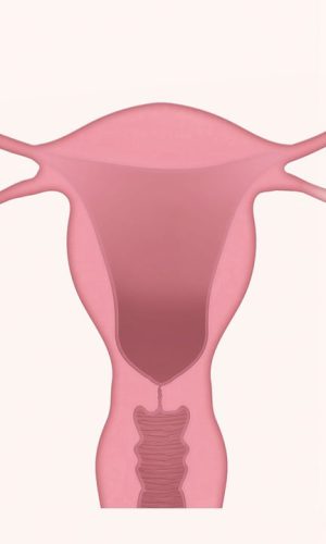 【子宮頸癌】症狀，症狀，病因及治療方法